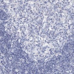 Invitrogen SLC37A4 Polyclonal Antibody 100 &mu;L; Unconjugated:Antibodies,