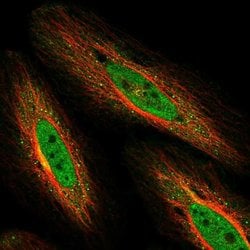 Invitrogen NEK10 Polyclonal Antibody 100 &mu;L; Unconjugated:Antibodies,