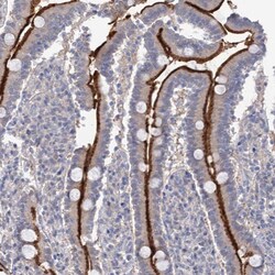 Invitrogen NEK10 Polyclonal Antibody 100 &mu;L; Unconjugated:Antibodies,