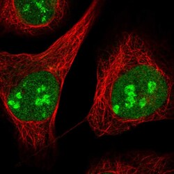 Invitrogen ZCCHC10 Polyclonal Antibody 100 &mu;L; Unconjugated:Antibodies,