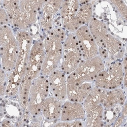 Invitrogen ZCCHC10 Polyclonal Antibody 100 &mu;L; Unconjugated:Antibodies,