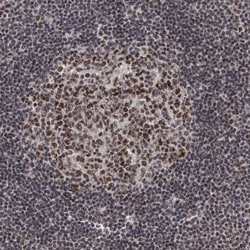 Invitrogen ZCCHC10 Polyclonal Antibody 100 &mu;L; Unconjugated:Antibodies,