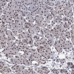 Invitrogen ZCCHC10 Polyclonal Antibody 100 &mu;L; Unconjugated:Antibodies,