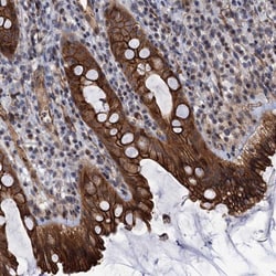 Invitrogen ABLIM1 Polyclonal Antibody 100 &mu;L | Buy Online | Invitrogen&trade; | Fisher Scientific