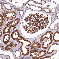 Invitrogen ANO6 Polyclonal Antibody 100 &mu;L; Unconjugated:Antibodies,