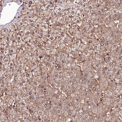 Invitrogen ANO6 Polyclonal Antibody 100 &mu;L; Unconjugated:Antibodies,