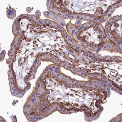 Invitrogen ANO6 Polyclonal Antibody 100 &mu;L; Unconjugated:Antibodies,