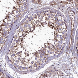Invitrogen ANO6 Polyclonal Antibody 100 &mu;L; Unconjugated:Antibodies,