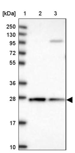 Invitrogen CYB5R2 Polyclonal Antibody 100 &mu;L; Unconjugated:Antibodies,