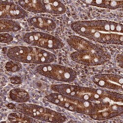 Invitrogen NUDT15 Polyclonal Antibody 100 &mu;L; Unconjugated:Antibodies,