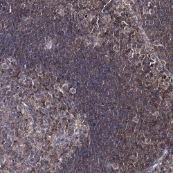 Invitrogen DEF6 Polyclonal Antibody 100 &mu;L; Unconjugated:Antibodies,