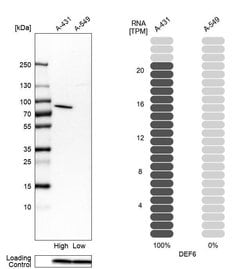Invitrogen DEF6 Polyclonal Antibody 100 &mu;L | Buy Online | Invitrogen&trade; | Fisher Scientific