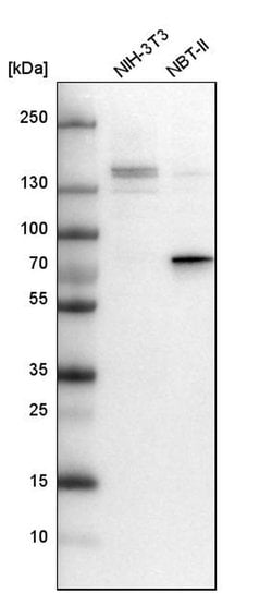 Invitrogen DEF6 Polyclonal Antibody 100 &mu;L | Buy Online | Invitrogen&trade; | Fisher Scientific
