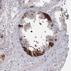 Invitrogen FDXACB1 Polyclonal Antibody 100 &mu;L; Unconjugated:Antibodies,