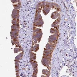 Invitrogen DYNC2H1 Polyclonal Antibody 100 &mu;L; Unconjugated:Antibodies,