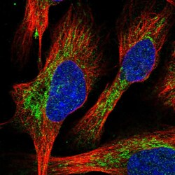 Invitrogen DYNC2H1 Polyclonal Antibody 100 &mu;L; Unconjugated:Antibodies,