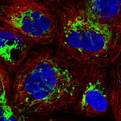 Invitrogen MMAB Polyclonal Antibody 100 &mu;L; Unconjugated:Antibodies,
