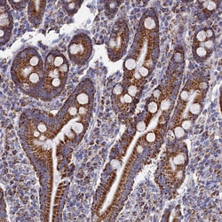 Invitrogen MMAB Polyclonal Antibody 100 &mu;L; Unconjugated:Antibodies,