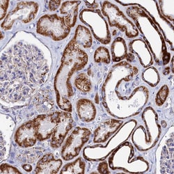Invitrogen MMAB Polyclonal Antibody 100 &mu;L; Unconjugated:Antibodies,