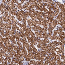 Invitrogen MMAB Polyclonal Antibody 100 &mu;L; Unconjugated:Antibodies,