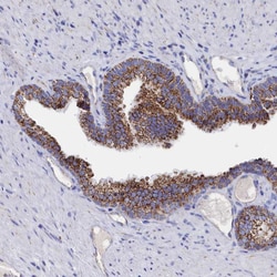 Invitrogen MMAB Polyclonal Antibody 100 &mu;L; Unconjugated:Antibodies,