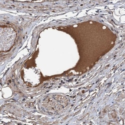 Invitrogen C14orf80 Polyclonal Antibody 100 &mu;L; Unconjugated:Antibodies,
