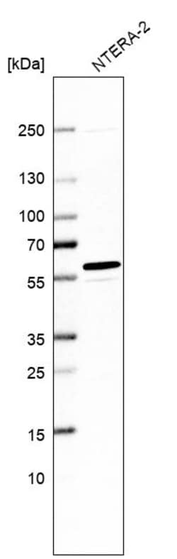 Invitrogen MCRS1 Polyclonal Antibody 100 &mu;L; Unconjugated:Antibodies,