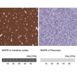 Invitrogen MAP6 Polyclonal Antibody 100 &mu;L; Unconjugated:Antibodies,