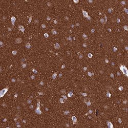 Invitrogen MAP6 Polyclonal Antibody 100 &mu;L; Unconjugated:Antibodies,