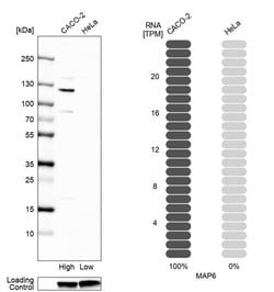 Invitrogen MAP6 Polyclonal Antibody 100 &mu;L | Buy Online | Invitrogen&trade; | Fisher Scientific