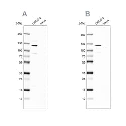 Invitrogen MAP6 Polyclonal Antibody 100 &mu;L | Buy Online | Invitrogen&trade; | Fisher Scientific