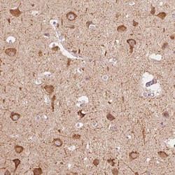 Invitrogen MAP1A Polyclonal Antibody 100 &mu;L; Unconjugated:Antibodies,