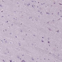 Invitrogen DNAH10 Polyclonal Antibody 100 &mu;L; Unconjugated:Antibodies,