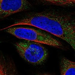 Invitrogen VWA8 Polyclonal Antibody 100 &mu;L; Unconjugated:Antibodies,