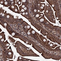 Invitrogen MRPS31 Polyclonal Antibody 100 &mu;L; Unconjugated:Antibodies,