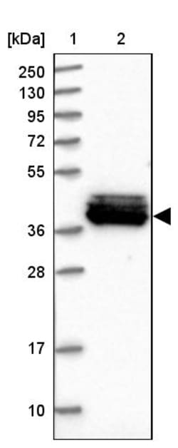 Invitrogen MRPS31 Polyclonal Antibody 100 &mu;L | Buy Online | Invitrogen&trade; | Fisher Scientific