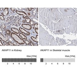 Invitrogen AKAP11 Polyclonal Antibody 100 &mu;L; Unconjugated:Antibodies,