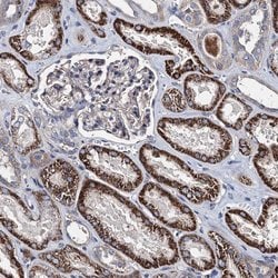 Invitrogen AKAP11 Polyclonal Antibody 100 &mu;L; Unconjugated:Antibodies,