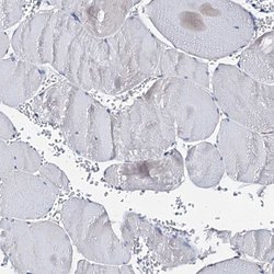 Invitrogen AKAP11 Polyclonal Antibody 100 &mu;L; Unconjugated:Antibodies,