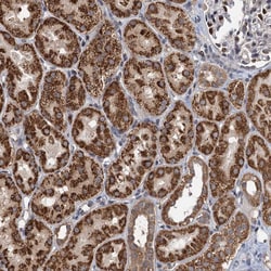 Invitrogen RITA1 Polyclonal Antibody 100 &mu;L; Unconjugated:Antibodies,