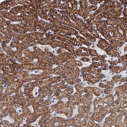 Invitrogen RITA1 Polyclonal Antibody 100 &mu;L; Unconjugated:Antibodies,