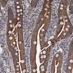 Invitrogen RITA1 Polyclonal Antibody 100 &mu;L; Unconjugated:Antibodies,
