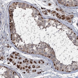 Invitrogen RITA1 Polyclonal Antibody 100 &mu;L; Unconjugated:Antibodies,