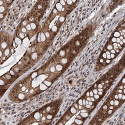 Invitrogen RITA1 Polyclonal Antibody 100 &mu;L; Unconjugated:Antibodies,