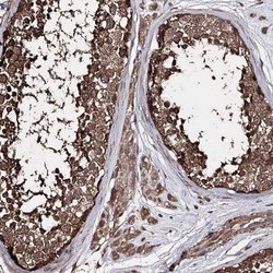 Invitrogen ZNF662 Polyclonal Antibody 100 &mu;L; Unconjugated:Antibodies,