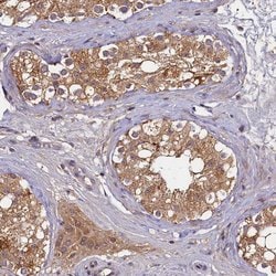 Invitrogen TMEM39A Polyclonal Antibody 100 &mu;L; Unconjugated:Antibodies,