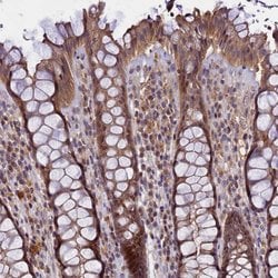 Invitrogen TMEM39A Polyclonal Antibody 100 &mu;L; Unconjugated:Antibodies,