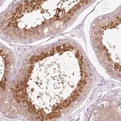 Invitrogen HSPA4L Polyclonal Antibody 100 &mu;L; Unconjugated:Antibodies,
