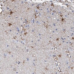 Invitrogen KLHL32 Polyclonal Antibody 100 &mu;L | Buy Online | Invitrogen&trade; | Fisher Scientific