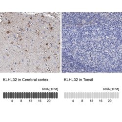 Invitrogen KLHL32 Polyclonal Antibody 100 &mu;L | Buy Online | Invitrogen&trade; | Fisher Scientific